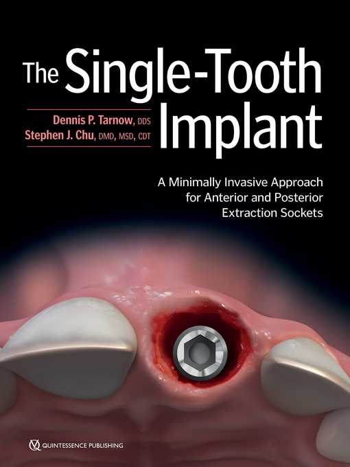 Title details for The Single-Tooth Implant by Dennis P. Tarnow - Wait list